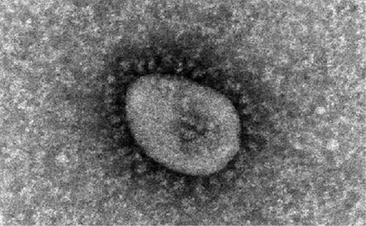 オミクロン株の電子顕微鏡画像。従来型でBA.5ではないが、形状は似ているとみられる（国立感染症研究所提供）