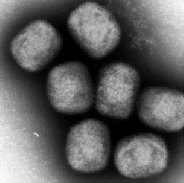 サル痘ウイルスの電子顕微鏡写真（国立感染症研究所提供）