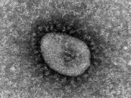コロナウイルスのゲノム変異に未知の仕組みか、大流行解明に光 東北大