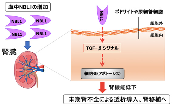 研究の概念図。たんぱく質「NBL1」が細胞死（アポトーシス）を誘導し、組織の線維化などを引き起こすことで、糖尿病性腎症を悪化させると考えられる（小林助教らの研究グループ提供）