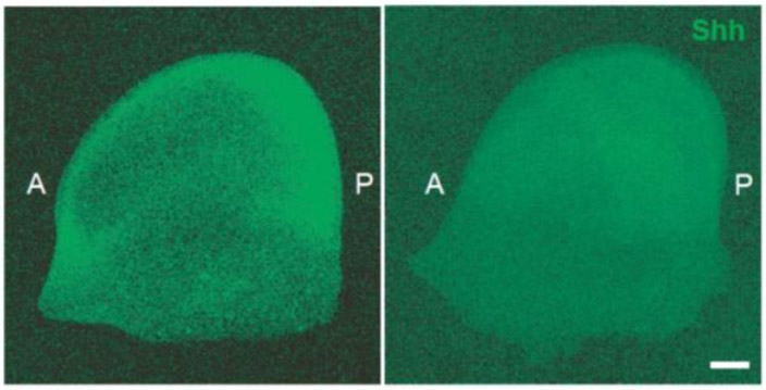 マウスの胎児の体肢芽のSHHを染色した画像。正常マウス（左）はSHHがたまる場所があり、小指側（P）から親指側（A）へ濃度勾配が見られる。KIF3Bが機能しないマウスはSHHが体肢芽全体に拡散し、濃度勾配が崩れている（東京大学/広川信隆東京大学特任研究員提供）