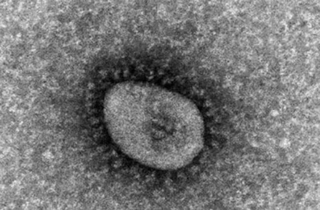 国立感染症研究所が分離したオミクロン株の電子顕微鏡画像（国立感染症研究所提供）