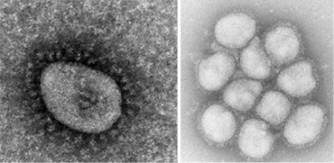 新型コロナウイルス・オミクロン株（左）と、インフルエンザウイルスのA型の一種で2009年に大流行したH1N1型の電子顕微鏡画像（国立感染症研究所提供）
