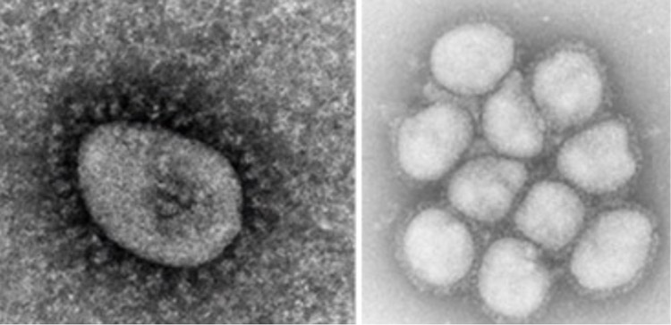 新型コロナウイルス・オミクロン株（左）と、インフルエンザウイルスのA型の一種で2009年に大流行したH1N1型の電子顕微鏡画像（国立感染症研究所提供）