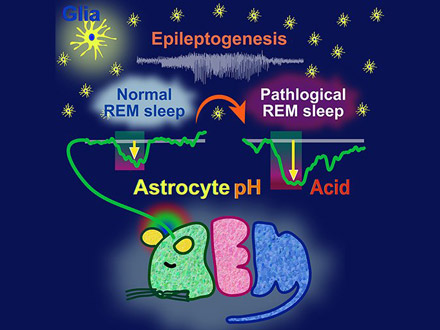 レム睡眠の前、グリア細胞が酸性化 てんかん診断や治療につながる可能性