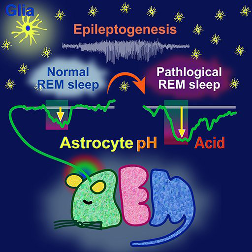 てんかん発作（Epileptogenesis）では病的な（Pathological）レム睡眠となる。この時、グリア細胞の一種のアストロサイト（Astrocyte）の酸性（Acid）化が強まっている（東北大学超回路脳機能分野提供）
