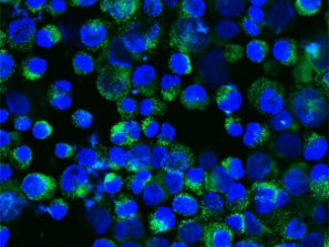 カイコ培養細胞内にボルバキアを共生させた蛍光顕微鏡写真。青:カイコ細胞の核。緑:ボルバキア（農研機構提供）