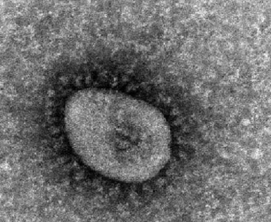 新型コロナウイルスのオミクロン株（従来型）の電子顕微鏡画像（国立感染症研究所提供）