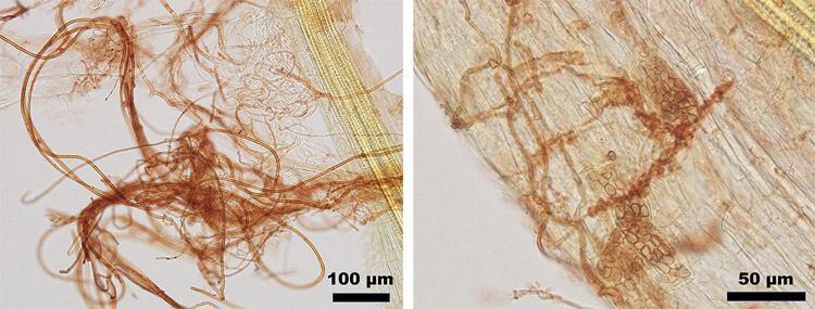 外生菌根樹種（アラカシ）では菌糸が根の周囲に伸び、絡まりあってネットワークを形成している（左）。アーバスキュラー菌根樹種（アカメガシワ）では根の表皮にさまざまな菌の感染が確認できる（右）（京都大学農学研究科修士1年・橋本侑弥さん提供）