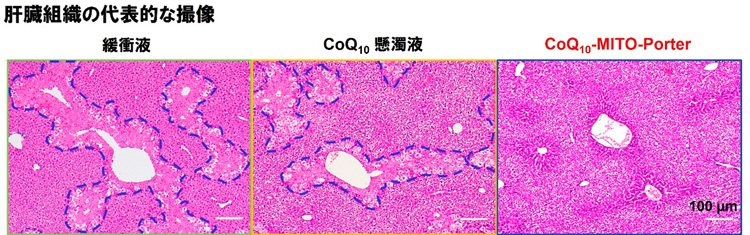 マウスに対し、コエンザイムQ10をミトコンドリアにナノカプセルで届けた（写真右）ところ、病変が小さくなっていることが確認された。コエンザイムQ10の懸濁液（中）、何も入っていない緩衝液（左）では効果がなかった（北海道大学提供）