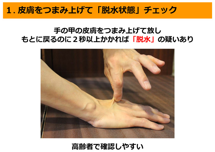 高齢者らの脱水状態をチェックする有力な方法として手の皮膚をつまみ上げるやり方（「働く人の今すぐ使える熱中症ガイド」から、厚生労働省提供）