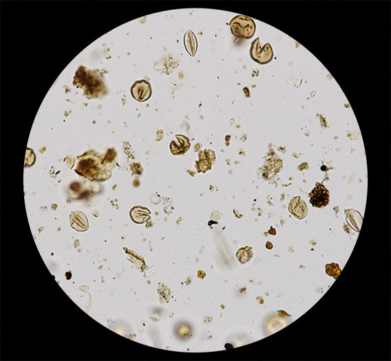 水月湖で見つかった年縞に含まれていた花粉の化石の顕微鏡画像（中川さん提供）