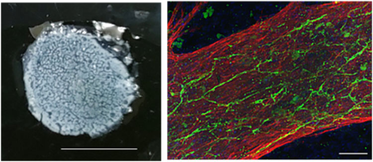 （左）はiPS細胞から作製された「心臓マイクロ組織」（CMT）の全体像（右）はCMTの一部組織（血管網様構造）（理研提供）