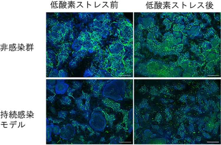 4画像のうち右の（上）（下）はヒトの虚血性心疾患を模した低酸素状態のCMT。右の（上）はウイルスに感染していないCMTで網様構造が保たれているが、右の（下）感染させたCMTは構造が崩れている（理研提供）