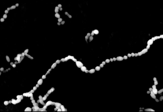 A群溶血性連鎖球菌の電子顕微鏡写真（東京都感染症情報センター提供）
