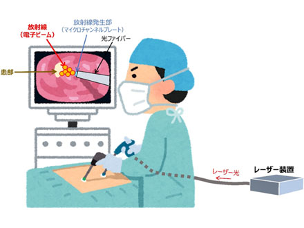 レーザーから高エネルギーの電子線を発生 小型装置によるがん放射線治療に道 量研機構など