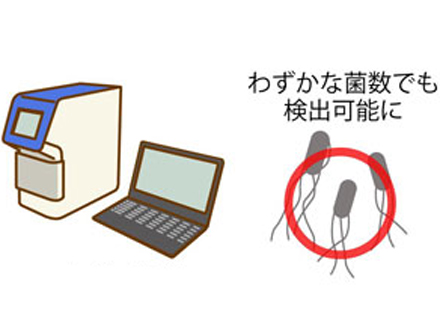 新興食中毒の原因菌を2時間で迅速検出、大阪公立大が手法確立 早期の救命に道