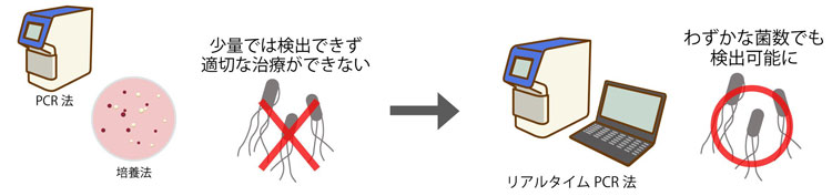 今回確立した検出手法。菌の数は10個あれば良く、約2時間で特定が可能になった(大阪公立大学提供)
