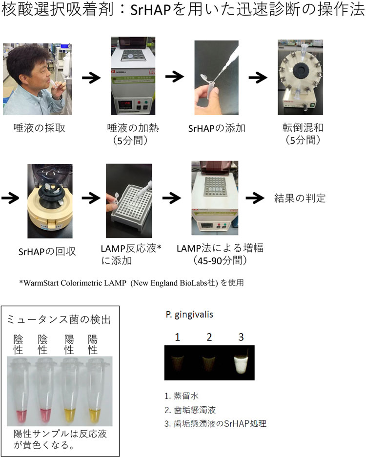 SrHAPを用いた迅速診断の操作法。ミュータンス菌を検出した様子(左下)と、Pg菌を検出した様子(右下)(長嶺憲太郎教授提供の図を基に編集部改編)