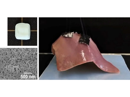臓器のための簡単な接着材開発 外科手術短縮へ 岡山大など