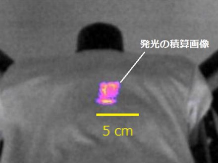 ポリエステル生地が放射線で発光することを発見、治療に応用も 早大など