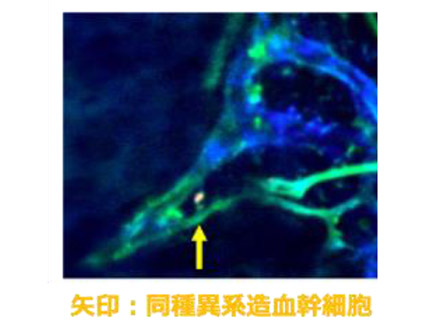 移植した造血幹細胞の免疫回避と再生能力維持、血液の流れがきっかけに 名大など