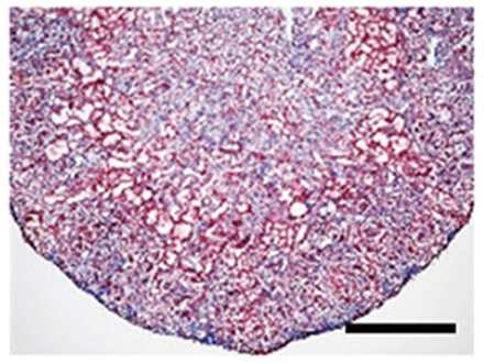 慢性腎臓病をiPS技術で治療 京大など、マウスで効果確認 数年以内に臨床試験目指す