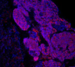 CKDマウスの腎臓に移植したiPS細胞由来腎前駆細胞(ピンク色に光っている部分)(京都大学iPS細胞研究所提供)