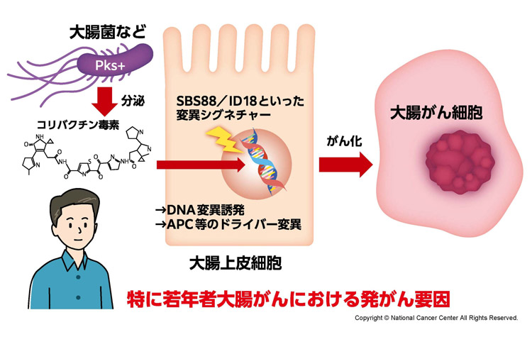 国立がん研究センターが発表した研究成果の概念図(国立がん研究センター提供)