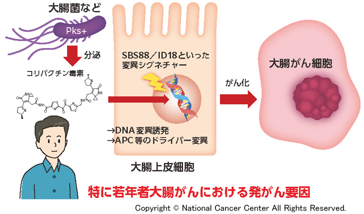 国立がん研究センターが発表した研究成果の概念図（国立がん研究センター提供）