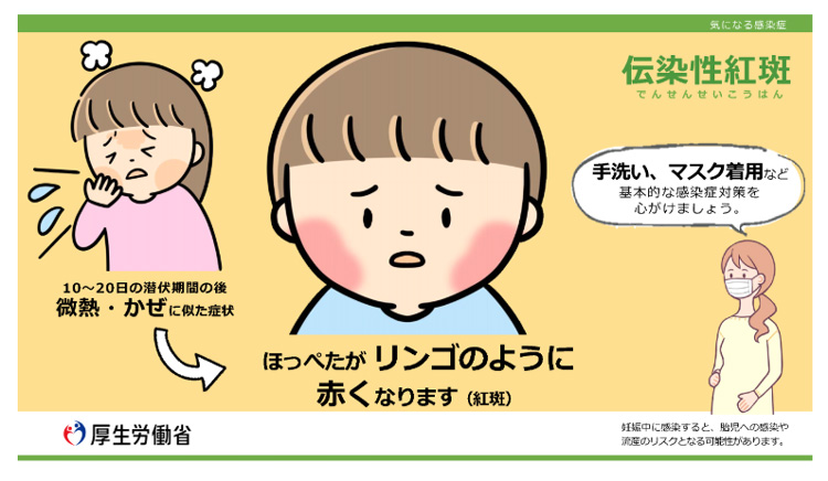 厚労省がリンゴ病感染対策の注意喚起のために作成したチラシ（厚労省提供）