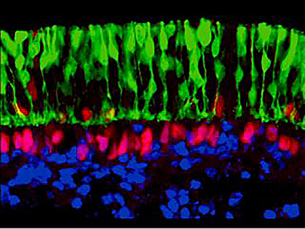 ヒトES細胞で立体網膜を作製
